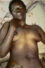 HIV/AIDS