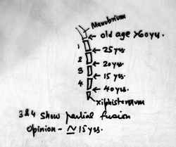 Figure 2. Diagram showing the fusion of various parts of sternum [37 kb]