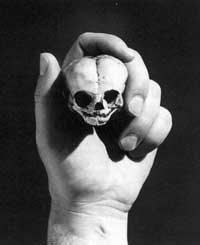 A human fetal skull. Is it right or wrong for this unborn individual's remains to be curated in a museum? Different people give different asnwers to this question depending on what ethical perspective they bring to the issue