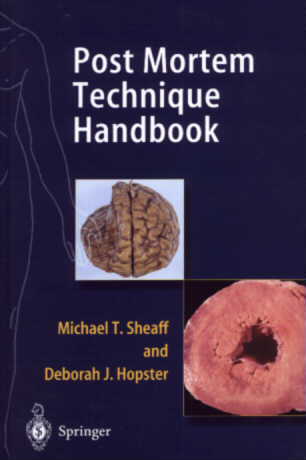 Post Mortem Technique Handbook