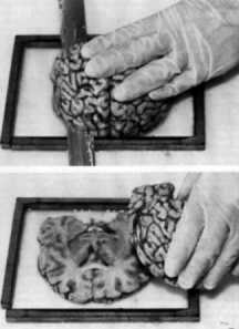 Postmortem technique handbook