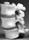 Three lumbar vertebrae, flexibly mounted 
