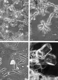 are these diatoms?