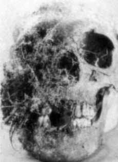 Bones - A Forensic Detective's Case Book