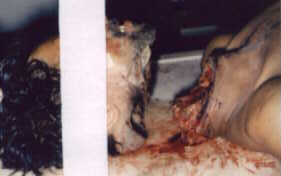 poster 2 - Accidental Guillotine