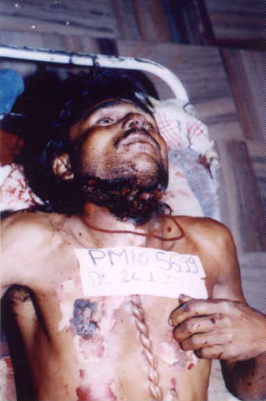 poster 2 - Electrocution, Suspicion of manipulation at the neck