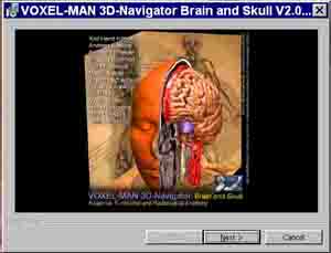 Voxelman 3D installation