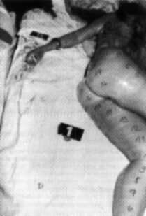 serial 1:1 taping to collect fibres