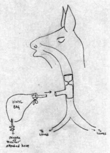 How the cannula is inserted