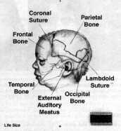 Demonstrative Evidence