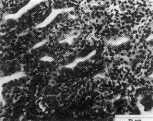 Thyroid gland from the pigeon, dosed with DDT