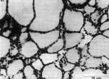 Thyroid gland from the pigeon, in quiescent sate