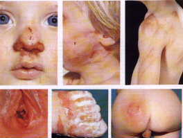 ABC of Child Abuse - Some common forms of child abuse