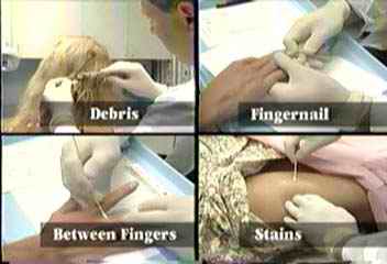 proper way to take samples from a rape victim