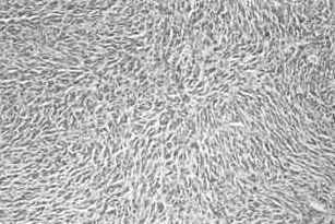 Endocrine Pathology- Differential Diagnosis And Molecular Advances