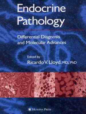 Endocrine Pathology- Differential Diagnosis And Molecular Advances