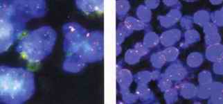 Endocrine Pathology- Differential Diagnosis And Molecular Advances