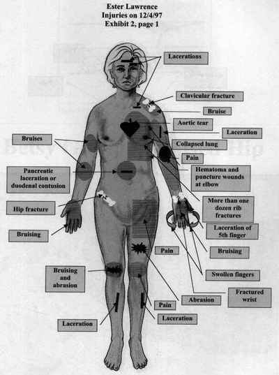 Medical - Legal Aspects Of Pain And Suffering by Patricia W. Iyer