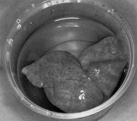 Infant body wrapped in a towel and blanket found hidden in a cupboard following a concealed home delivery