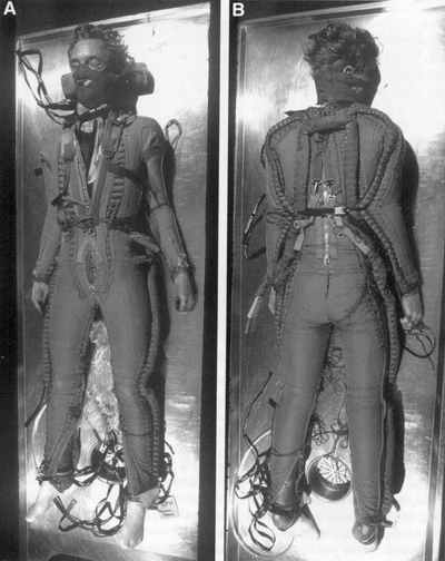 Accidental autoerotic death