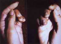A close up view shows that Pilar MacArthur's hands have no blood-spatter deposits