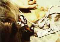 The ligature tied around JonBenet Ramsey's neck and right wrist