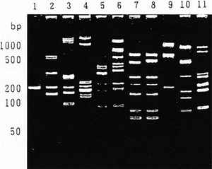 Figure 7. Electrophoretic pattern of the PCR product using pairs of primers for ABO genotyping.
M;174/Hae III, 1;Human, 2;Japanese Monkey, 3;pig, 4;Cat, 5;Rabbit, 6;Chinese Hamster, 7;Rat(Wistar), 8;Rat(Fischer), 9; Mastomys, 10;Mouse, and 11: Goldfish