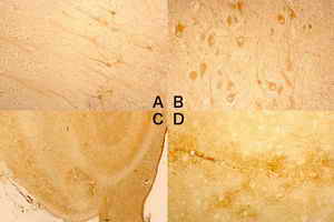 Figure 8. Expression of Le x antigen in the human brain.
Neuronal cell surface in the hippocampus (A) and selected cells in the mid brain (B) from 2 months baby were stained by anti Le x. The boundary reactivity with anti Le x was observed and the Le x antigen was expressed on the outer surface of the unstained granular cells (C) in the granular cell layer of the dentate gyrus of the hippocampus from young adult. Astrocytes and microglia in the hippocampus from elderly were stained by anti Le x (D)