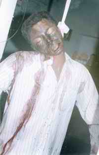 Figure 2: Photograph showing the deceased suspended at scene of death. The knot is on the left back side of the neck. Notice blood streaked salivary stains running over the shirt on front right.