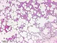 Figure 6. Comparative histology of the lungs (a) of the woman (b) of the dog (H & E stain); in both cases emphysema and diffuse edema are visible.