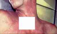 Figure 2. Photograph at beginning of post-mortem examination, approximately 22 hours post-mortem.