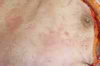 Figure 4. Photographs at completion of post mortem examination, approx 24 hours post mortem, demonstrate only trace erythema