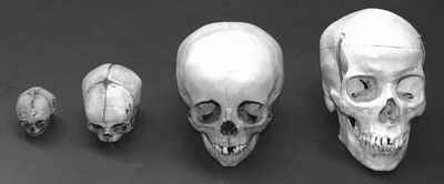 Figure 2: Frontal view of four skulls: Fetus (6-7 lunar months), Fetus (8-9 lunar months), child (3-4 years), and an adult man (25-35 years)