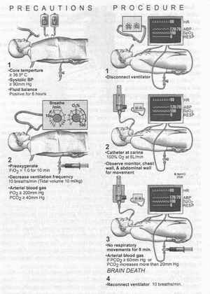 Arm elevation with neck flexion (A) and spontaneously (B)