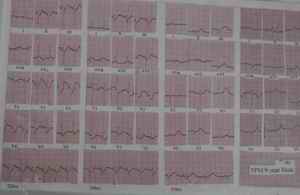 Figure 9- Recovery by dobutamine and Prazosin