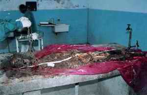 Picture 1: Depicting the dead body (almost skeletonized) with the rope (ligature material) lifted up for better appreciation