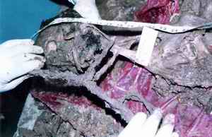 Picture 2a and 2b: Close up view of the head and neck area with only few putrefied tissues remaining with ligature material in situ.
