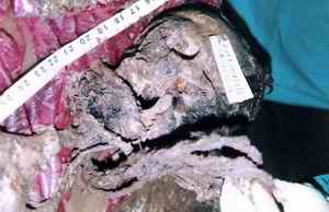 Picture 2a and 2b: Close up view of the head and neck area with only few putrefied tissues remaining with ligature material in situ.