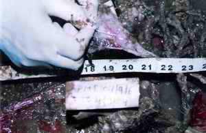 Picture 4a and 4b: Showing ecchymosis in laryngeal structures visualized even after 6 months in a gutter in this skeletonized body.