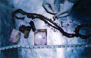 Picture 5a and 5b: Showing ecchymosis in laryngeal structures visualized even after 6 months in a gutter in this skeletonized body.