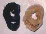 Figure 1. Normal uniform staining with NBT (Nitro Blue Tetrazolium chloride) (L) compared with unstained slice of heart (R)