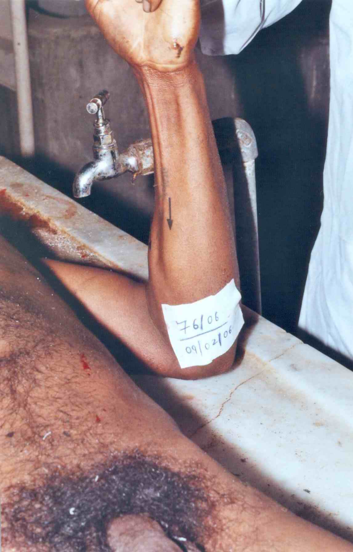 poster 5 - Rigor Mortis Photographed