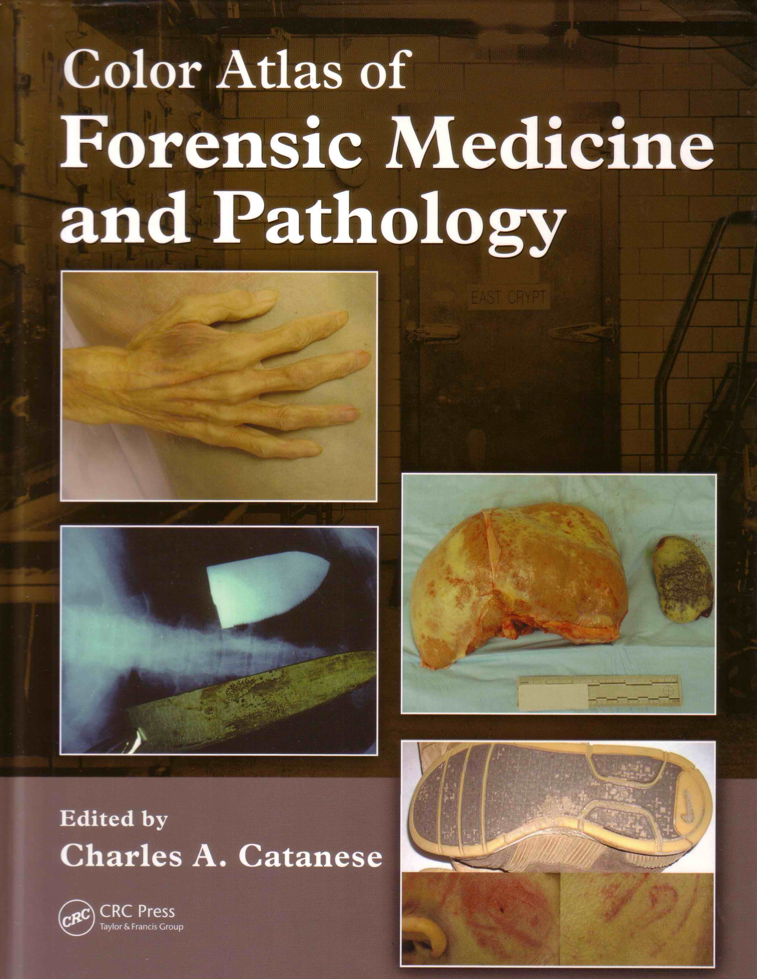 Color Atlas of Forensic Medicine and Pathology, Book and DVD Set, First Edition edited by Charles A. Catanese