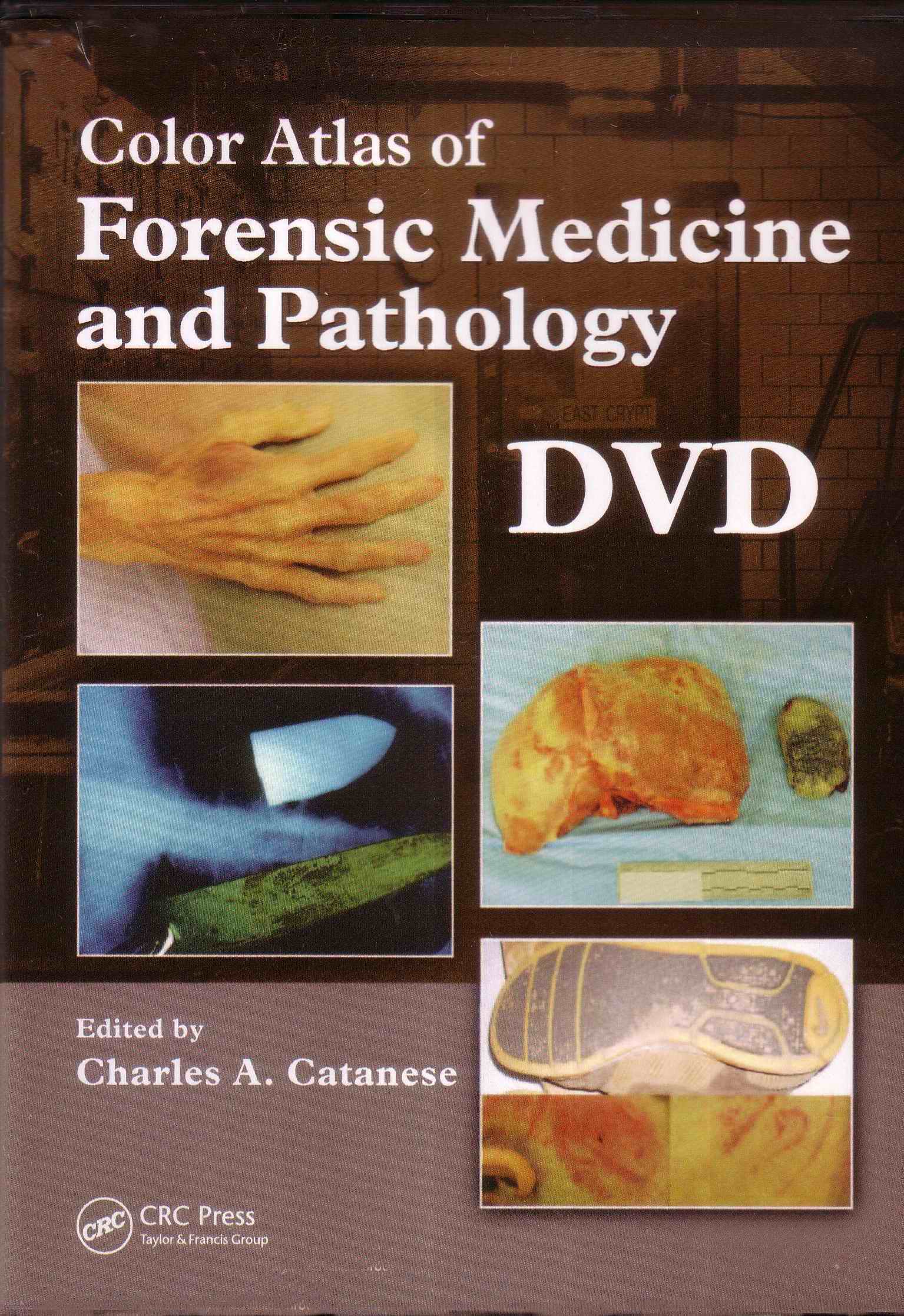 Color Atlas of Forensic Medicine and Pathology, Book and DVD Set, First Edition edited by Charles A. Catanese