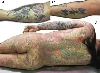 Figure 1. Tattoos all over the body of the deceased (A). At the time of his death, the deceased was working at a tattoo parlor and presumably had been practicing on his own body, especially in legs (B and C). [Click all pictures to enlarge]