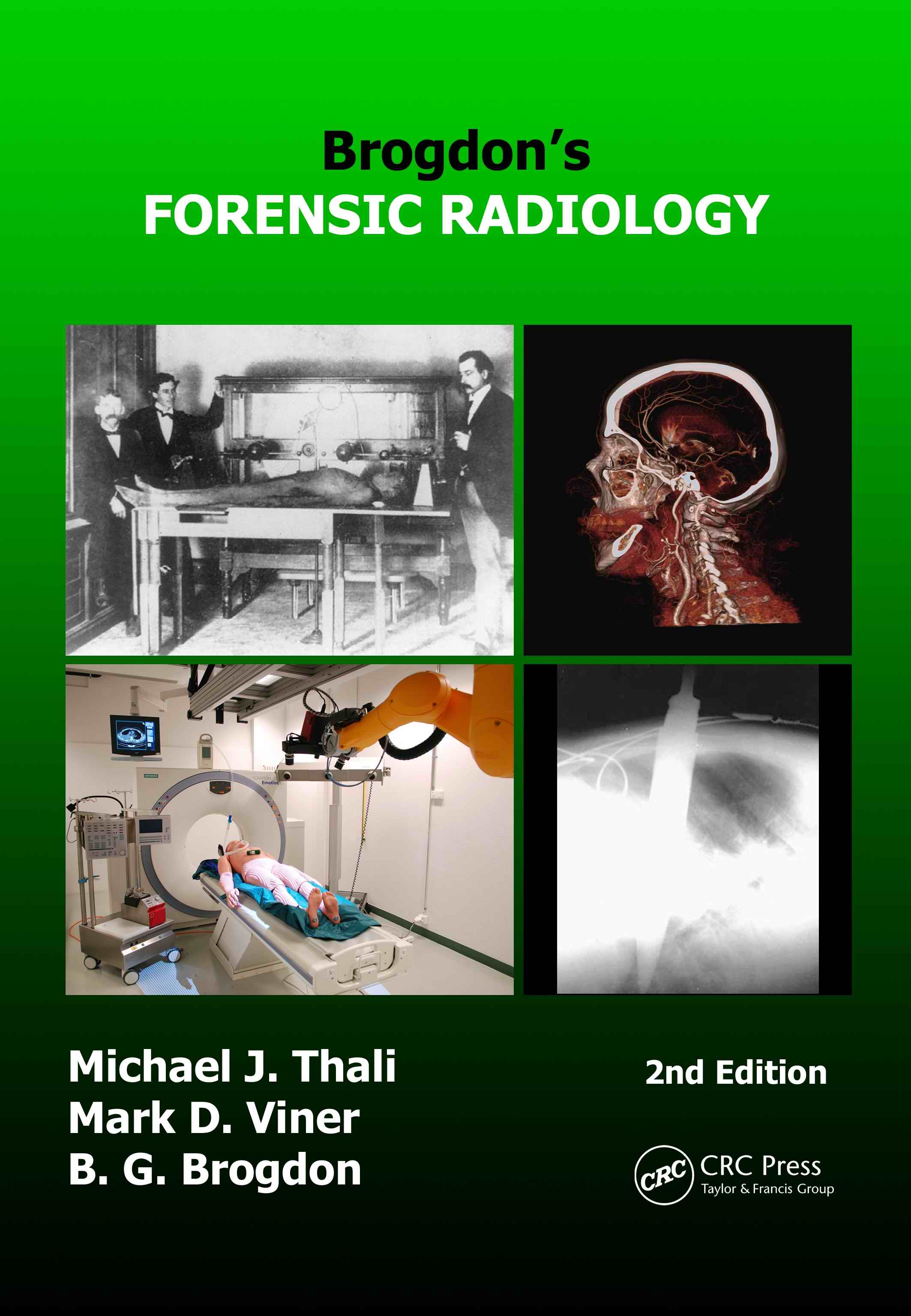 Brogdon's Forensic Radiology