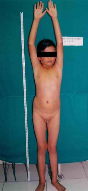 Figure 2. The boy in question