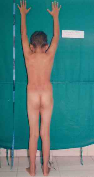 Figure 1. The boy in question
