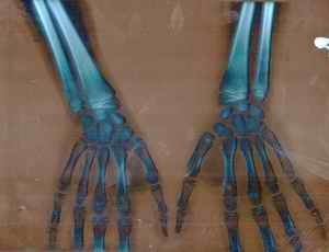 Figure 3. Findings on radiological examination