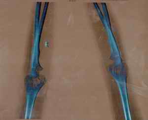 Figure 4. Findings on radiological examination